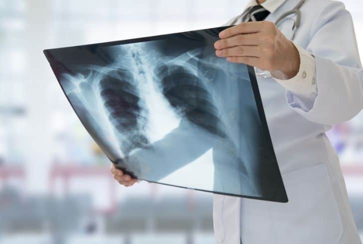 醫(yī)療廢物X射線報告銷毀